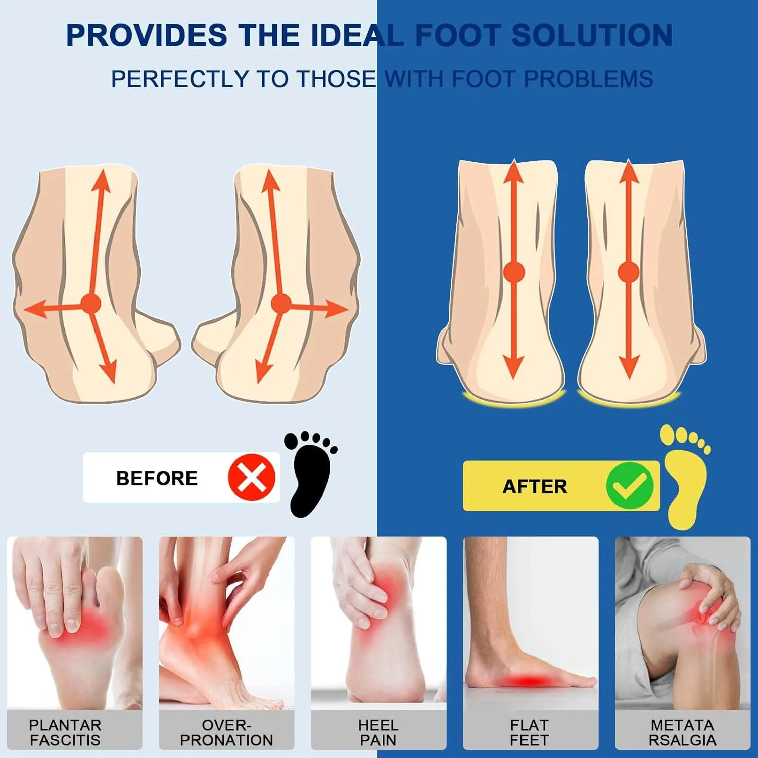 Plantar Fasciitis Insoles, High Arch Support Shoe Inserts Men Women, Orthotics Gel Running Insoles for Flat Feet - Arch Pain - Pronation - Metatarsalgia Pain Relief Heavy Duty Support(Trim to Fit)